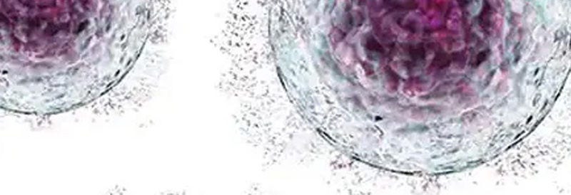 Lab Reporter: Equipment Challenges in Scaling-Up Cell Therapy Processes