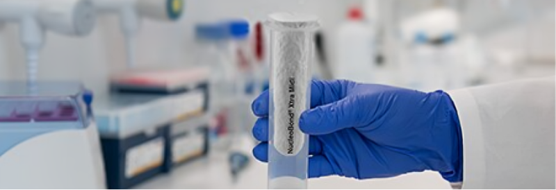 Challenges of Plasmid DNA Used for Biopharma and Gene Therapy